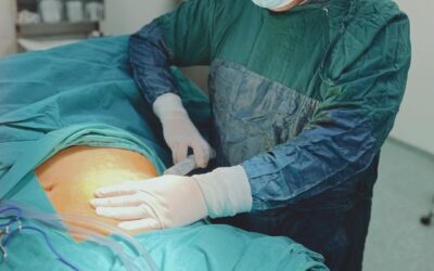 Blog – Buikwandcorrectie vs. liposuctie: wat is het verschil?
